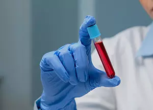 Laboratorijska dijagnostika